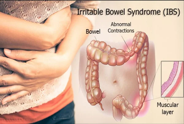 IBS