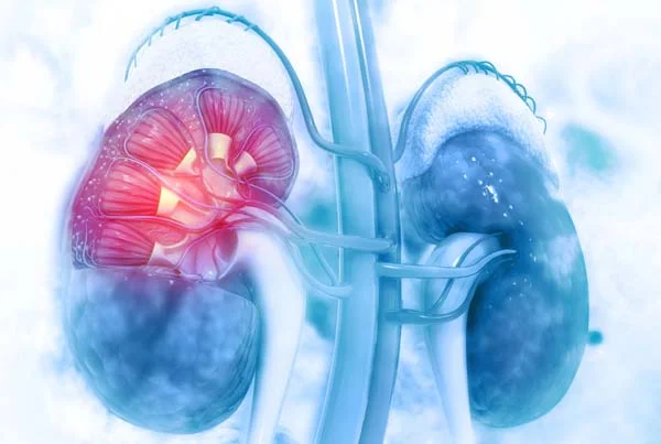 Acute Kidney Disease